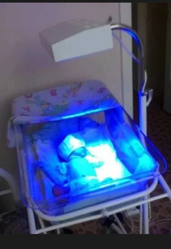 Fototerapiya apparati fotolampa