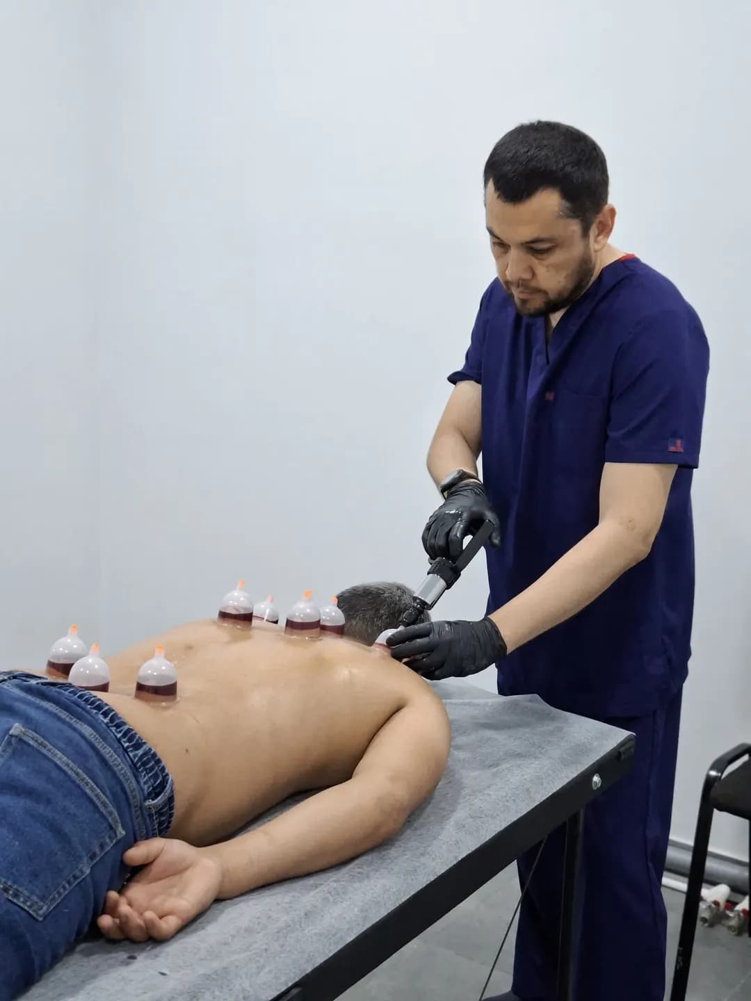 Cupping and Leech Service