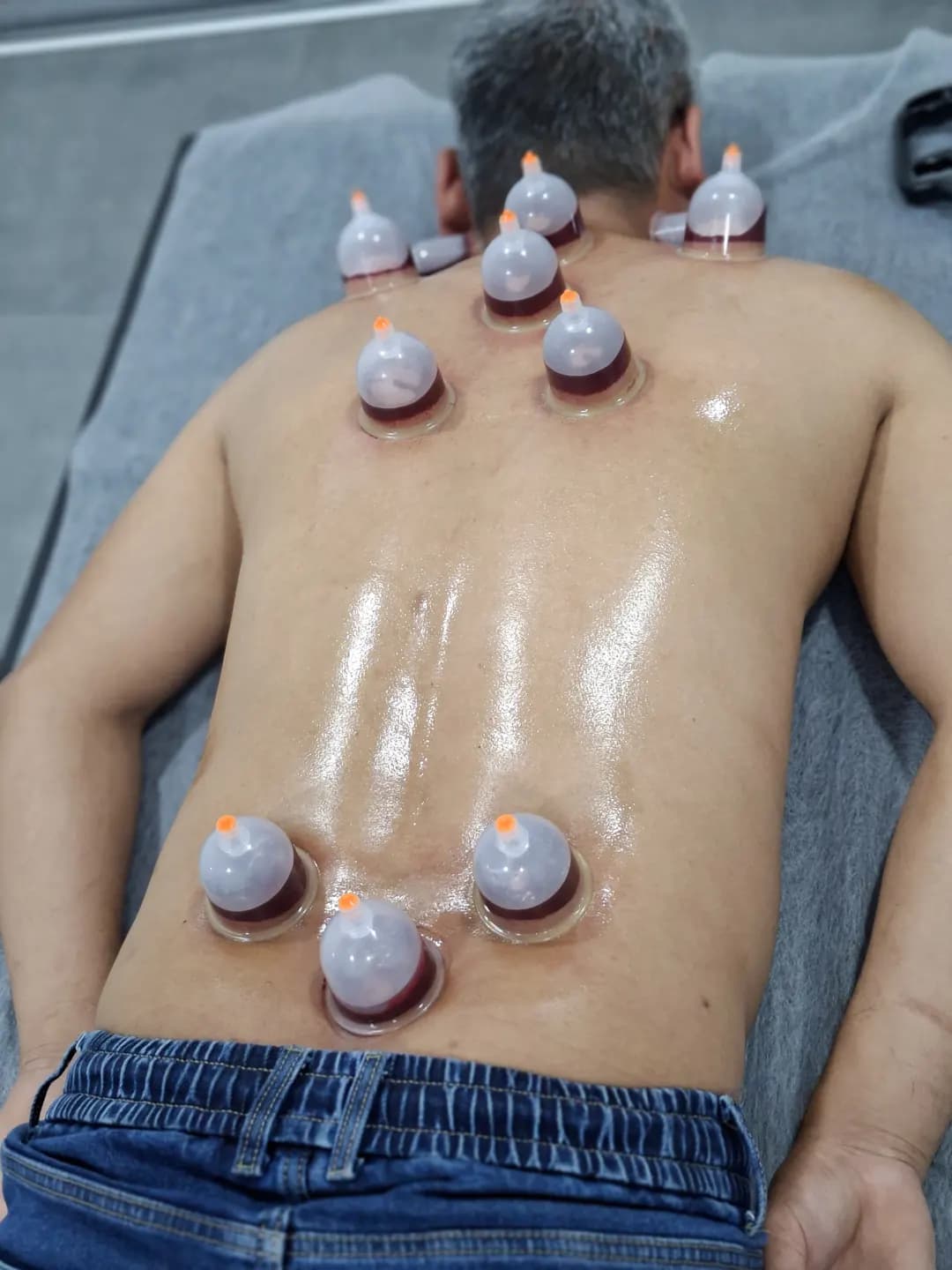 Cupping and Leech Service