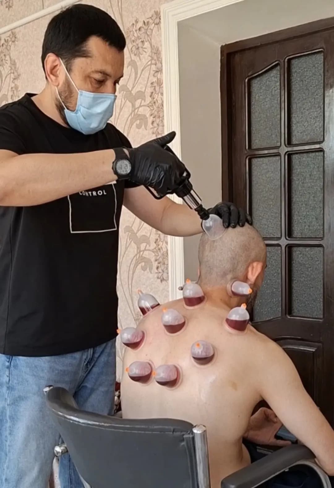 Cupping and Leech Service