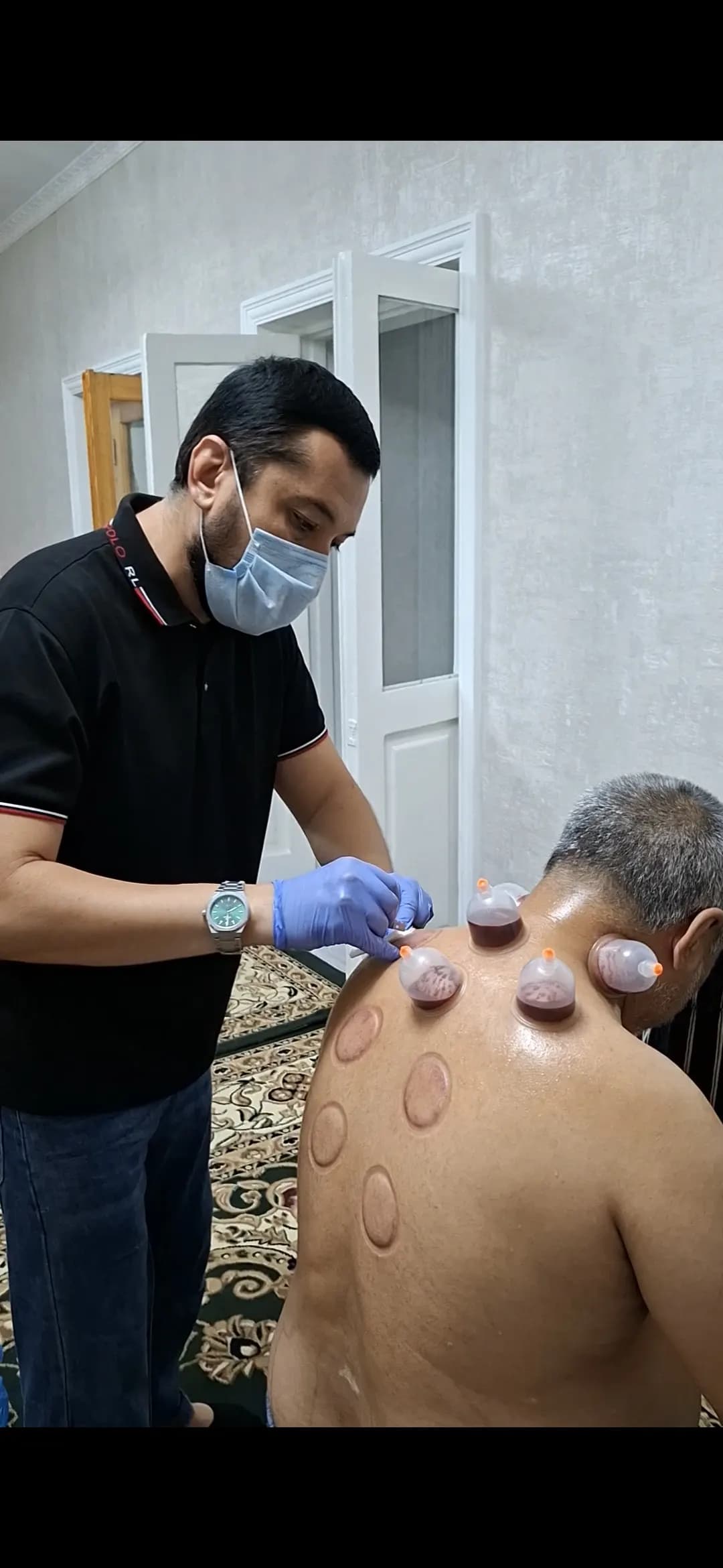 Cupping and Leech Service